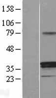 NBL1-11718 - HSD11B1 Lysate